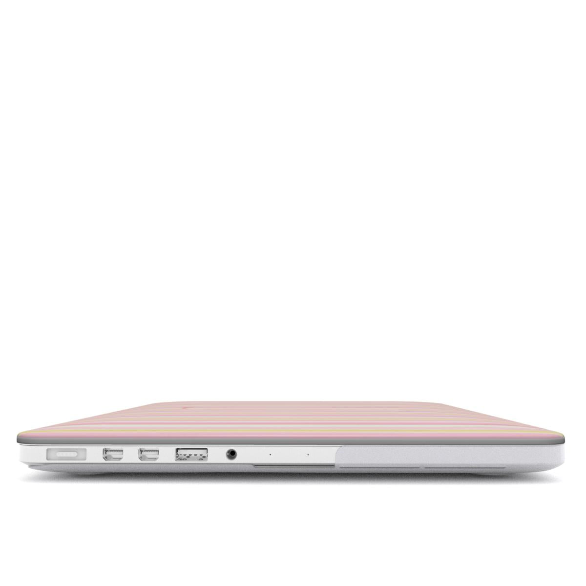 Lines MacBook Case